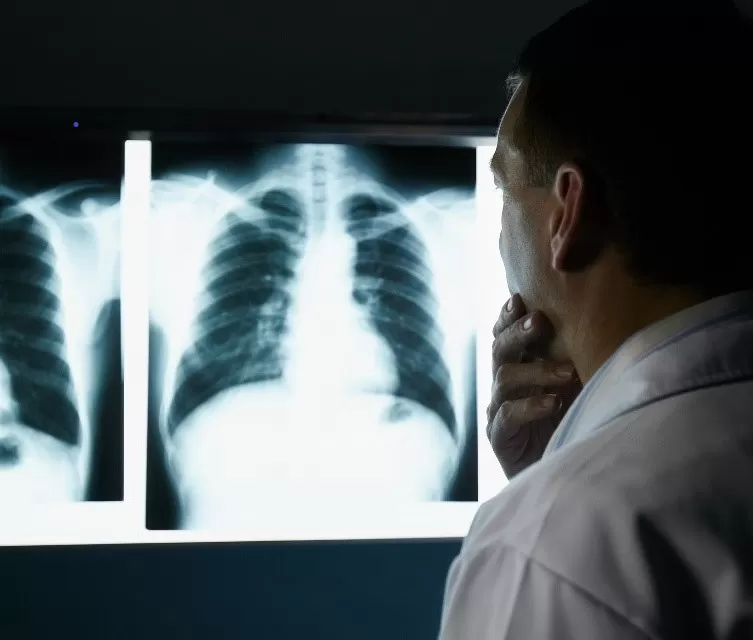 Médico analisando pulmão